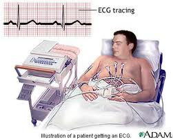 الکتروکاردیوگرام (به انگلیسی: Electrocardiogram) یا نوار قلب